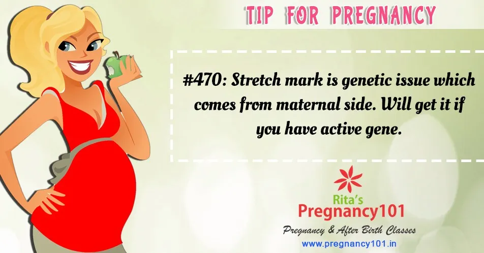 Stretch mark is genetic issue
