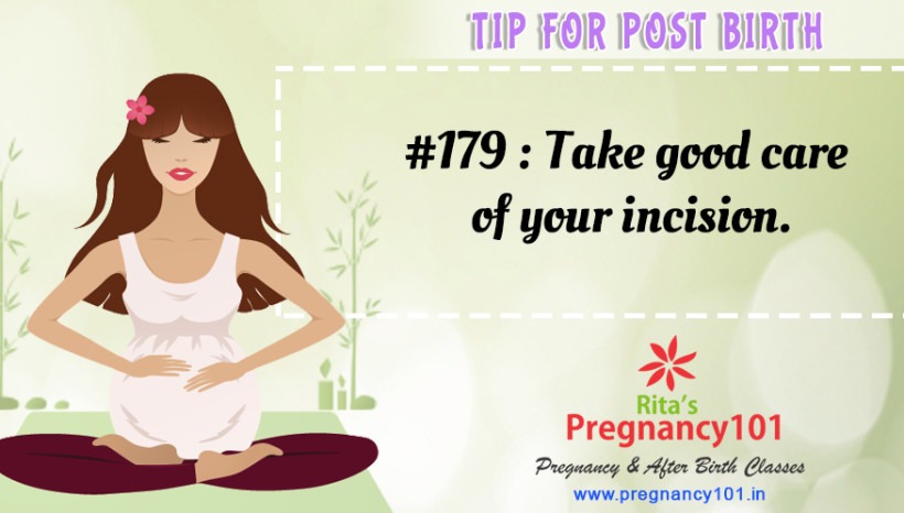 Tip Of The Day #179